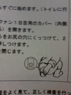 検査